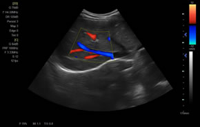 XF-7800彩色多普勒超聲診斷儀成像展示